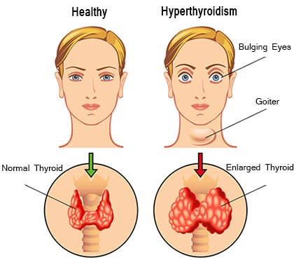 Endocrinology