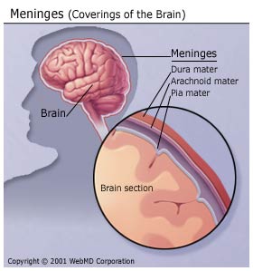https://cdnrmi-19948.kxcdn.com/sites/default/files/Disease-2020-06/meningitis.jpg