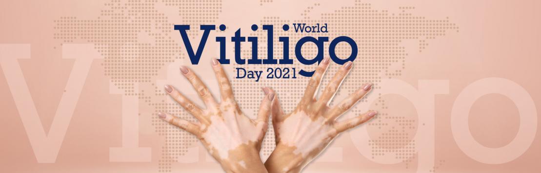 World Vitiligo Day 2021