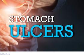 Stomach Ulcers 