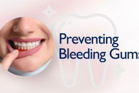 How to Prevent Bleeding Gums