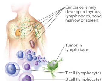 Non- Hodgkin lymphomas