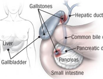Liver, Bile Duct and Pancreatic Disorders