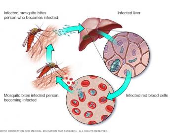 Malaria