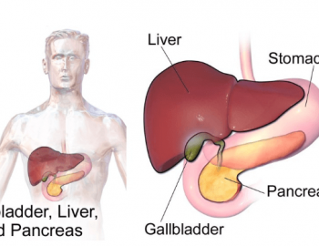 Gallbladder Cancer