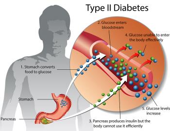Diabetes Type2