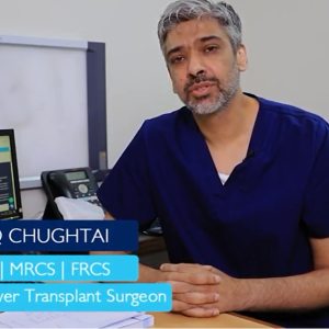 Dr. Shafiq Chughtai _ Consultant Liver Transplant 