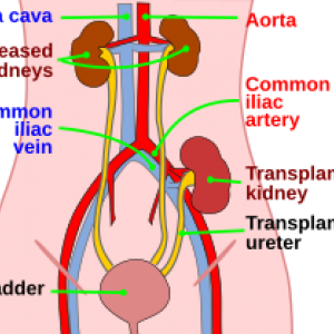 Nephrology procedures renal biopsy-RMI-Kidney-Unit-6th-Floor-General Hospital