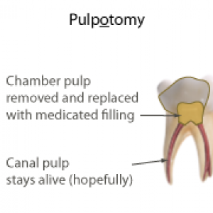 tooth