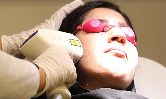 Laser Facilities (Hair Removal, Acne Scars, Mole Removal)
