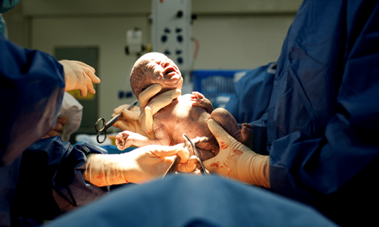 Obstetrics & Gynecological Procedures