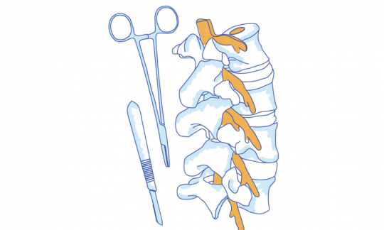 Orthopaedics & Spinal Procedures