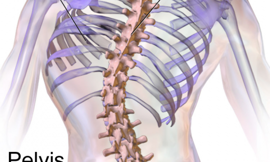 Reconstructive Surgery for Spinal Disorders