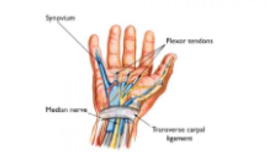 Tendon Nerve, Trauma, Congenital & Hand Surgery