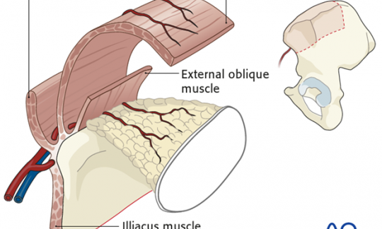 Skin Grafts & Flap Surgery