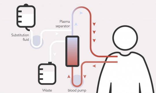 Plasma Exchange